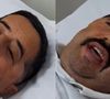 O que aconteceu com Bolachinha? Humorista cearense sofreu queda ao gravar programa da Record