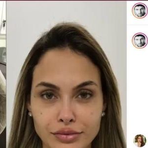 Já harmonizada, Sarah Andrade investiu em uma nova harmonização para definir mais seu rosto e contornos
