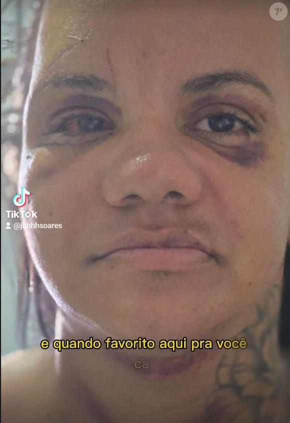 Juliana Soares ficou com o rosto desfigurado após levar 61 socos