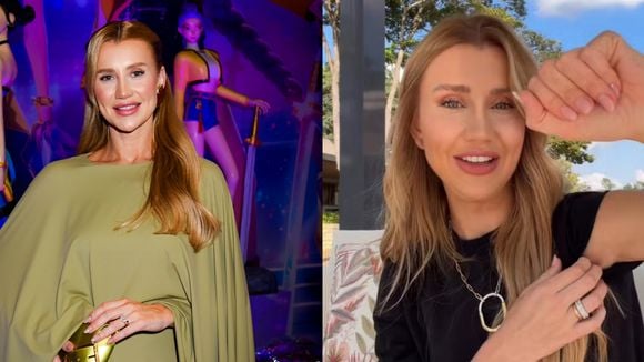De uma só vez: Ana Paula Siebert troca de silicone, faz blefaroplastia e + 2 procedimentos em única cirurgia; médico alerta: 'Segurança sempre vem antes da estética'