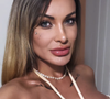 Andressa Urach usou suas redes sociais neste sábado (04) para revelar ter sofrido um surto nos últimos dias