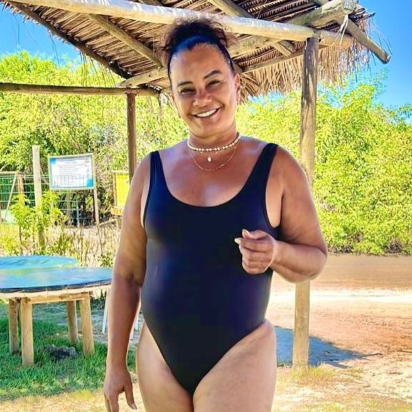 Diante das várias intervenções estéticas de Solange Couto, o Purepoeple conversou com o cirurgião plástico Dr. Jairo Casali para entender como funcionam os procedimentos