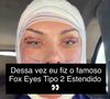 Andressa Urach vem mostrando em suas redes sociais todos os detalhes da cirurgia e seu processo de recuperação