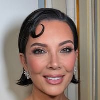Kris Jenner choca com antes e depois e médico revela segredo do rejuvenescimento da famosa aos 69 anos: 'Eficaz em pessoas idosas'