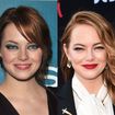 Emma Stone fez lifting facial? 35 fotos do antes e depois da atriz destacam mudança drástica na aparência em 19 anos