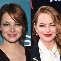 Emma Stone fez lifting facial? 35 fotos do antes e depois da atriz destacam mudança drástica na aparência em 19 anos