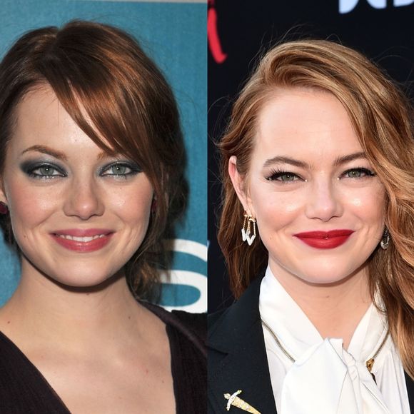 Antes e depois de Emma Stone: 35 fotos destacam transformação no rosto da atriz ao longo da carreira