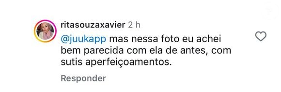 Internautas comentaram sobre o 'novo rosto' de Anitta.