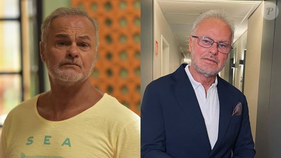 Antes e depois de Kadu Moliterno: o ex-ator da Globo fez uma harmonização facial aos 70 anos e o resultado foi muito elogiado na web