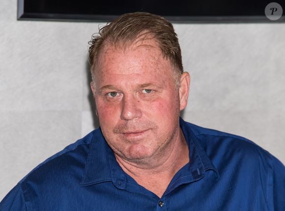 Irmão de Meghan Markle declarou que os médicos não deram outra opção: ‘Disseram-me que a perna tinha de ser amputada e que era uma questão de vida ou morte’