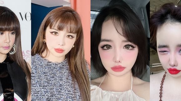 O que aconteceu com os olhos de Park Bom? Envolvida em processo milionário, cantora de K-Pop choca por visual irreconhecível. Veja 30 fotos do antes e depois!
