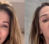 Aos 42 anos, Maíra Cardi expõe deformações no rosto após procedimento estético e risco de paralisia: 'Eu fui enganada'
