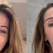 Meu Deus! Aos 42 anos, Maíra Cardi expõe deformações no rosto após procedimento estético polêmico e revela risco de paralisia: 'Eu fui enganada'