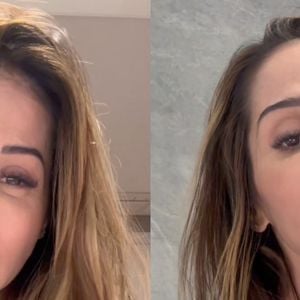 Aos 42 anos, Maíra Cardi expõe deformações no rosto após procedimento estético e risco de paralisia: 'Eu fui enganada'