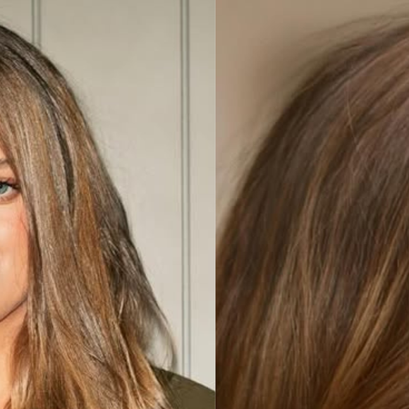 Veja antes e depois! Aos 16 anos, Rafaella Justus passa por segunda rinoplastia e ganha texto emocionado da mãe, Ticiane Pinheiro: ‘Reconhecer o que a incomodava’