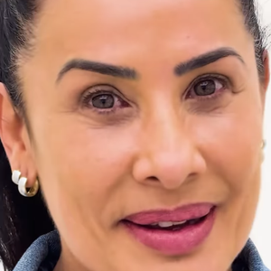 Resultado expressivo no rosto de Scheila Carvalho agradou fãs