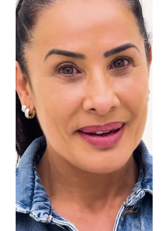 Resultado expressivo no rosto de Scheila Carvalho agradou fãs