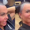 Gretchen relata que micropigmentação piorou o estado de sua alopecia; médicos debatem sobre complicações do procedimento: ‘Pode desencadear processos inflamatórios’
