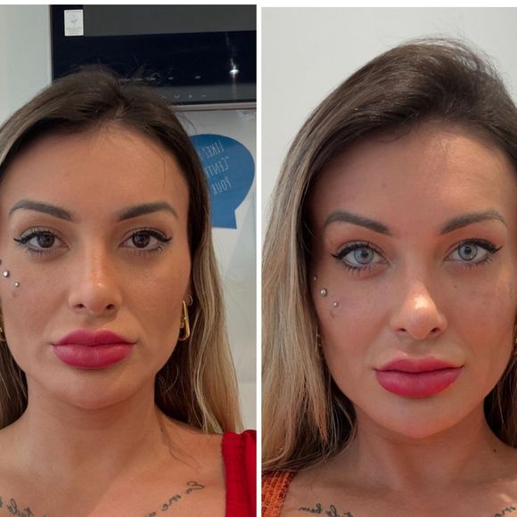 Antes e depois de Andressa Urach após mudar a cor dos olhos