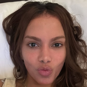 Anitta fez preenchimento labial e harmonização facial? A posição oficial da equipe da cantora sobre rumores do ‘novo rosto’