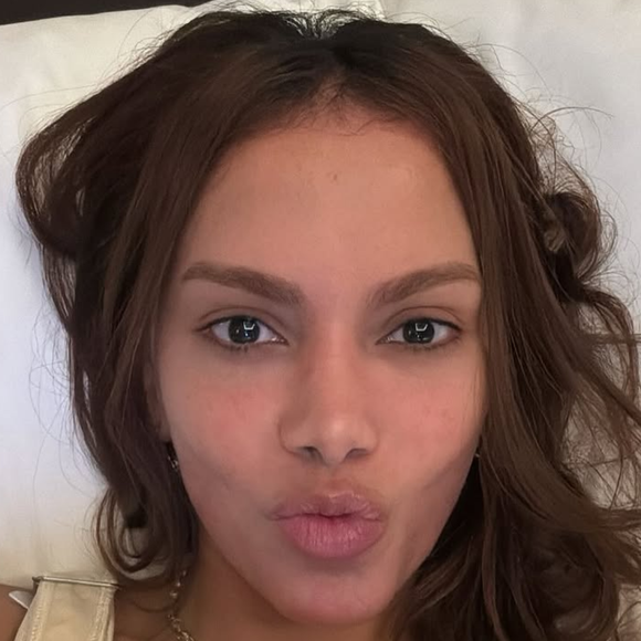 Anitta fez preenchimento labial e harmonização facial? A posição oficial da equipe da cantora sobre rumores do ‘novo rosto’