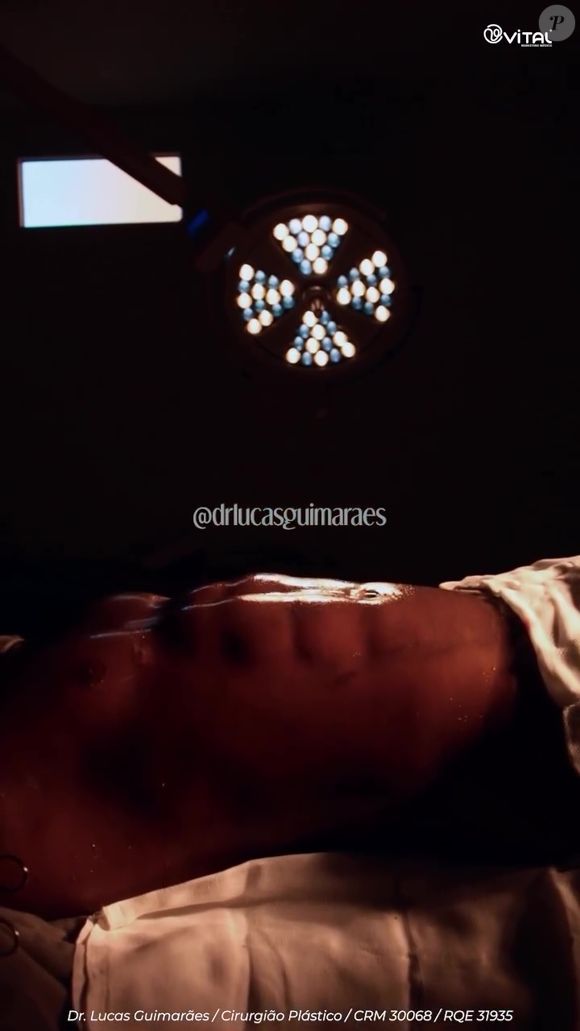 Davi Brito mostrou resultado da lipo HD no Instagram no domingo (27)