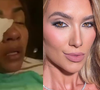 Virgínia Fonseca pede R$ 20 mil em processo contra youtuber que viralizou caso da cliente da WePink que quase ficou cega: ‘Linchamento’