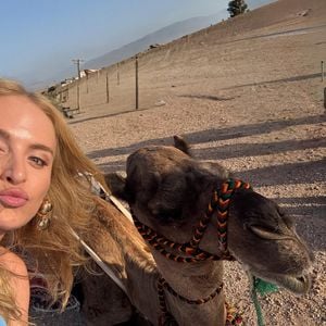 A máscara usada por Angélica "utiliza diferentes comprimentos de onda de luz para estimular a produção de colágeno, melhorar a circulação e reduzir inflamações", diz a especialista