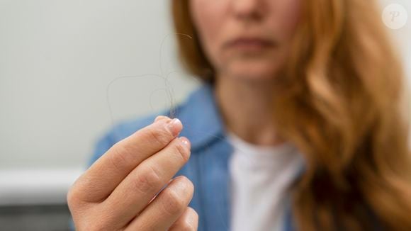 Também entram na lista as dietas restritivas, o uso frequente de produtos e tratamentos capilares agressivos e uma maior conscientização sobre o problema