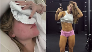 Treinar pode causar crises de enxaqueca? Médico tira dúvidas após Virgínia revelar mudanças em exercícios devido ao diagnóstico: ‘Priorizar regularidade em vez de intensidade’