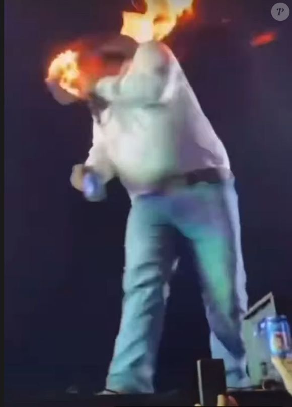Léo tentou apagar as chamas do rosto