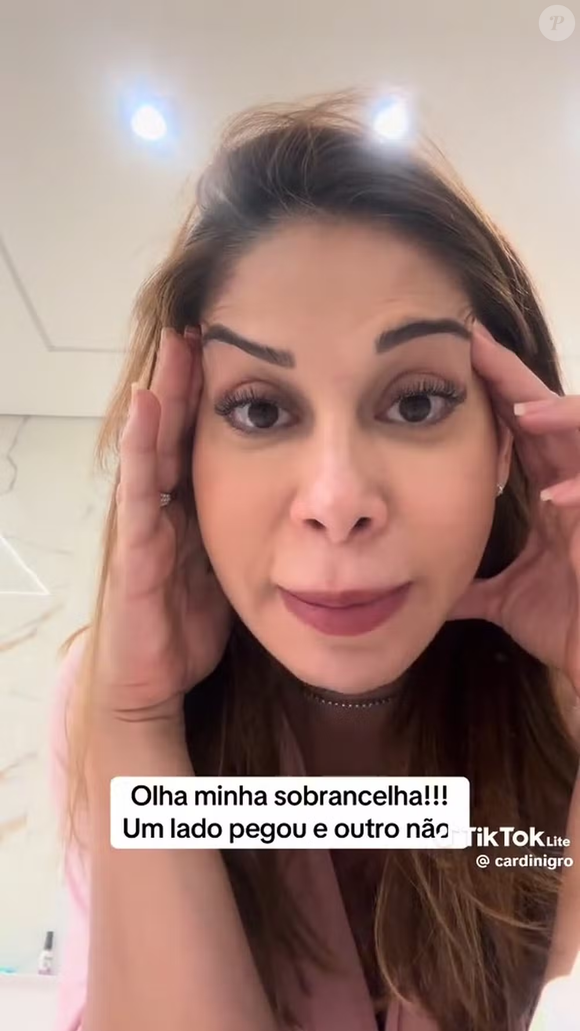 Maira Cardi passou por um problema após realizar um procedimento estético nesta terça-feira (18). Segundo a influenciadora, uma aplicação de botox não teve o resultado esperado e deixou sua expressão visivelmente assimétrica.