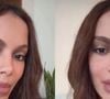 Anitta reage a rumores de 'problema psicológico' após surgir com rosto diferente devido a nova plástica: 'Seria ainda mais horrível'