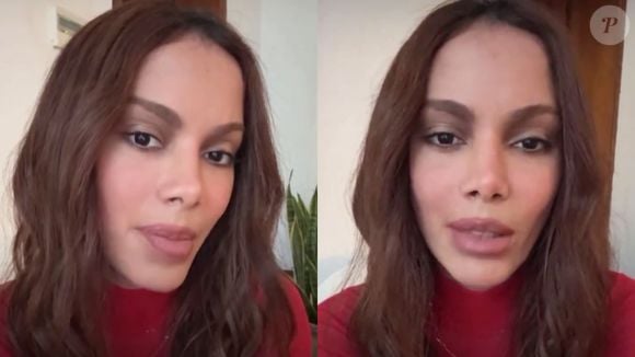 Anitta reage a rumores de 'problema psicológico' após surgir com rosto diferente devido a nova plástica: 'Seria ainda mais horrível'