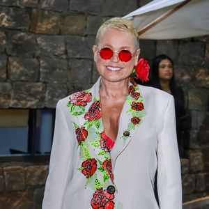 Xuxa Meneghel Xuxa passou recentemente por um transplante capilar.