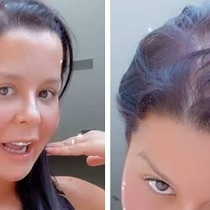 Maraisa convive com alopecia, uma doença que causa perda de cabelo.