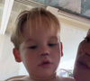 José Leonardo, filho de Virginia Fonseca e Zé Felipe, aparece em recuperação após levar 5 pontos no nariz em acidente doméstico