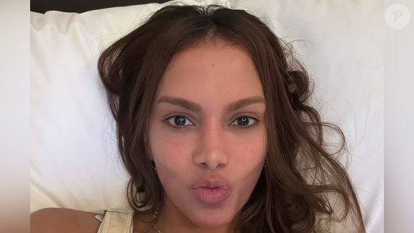 Anitta teria feito um lifting facial endoscópico, de acordo com especialistas