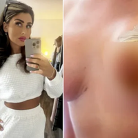 Uma mãe de 5 filhos voou à Turquia para uma cirurgia de silicone. Semanas depois, ela ainda está lá e já gastou milhares a mais do que planejou