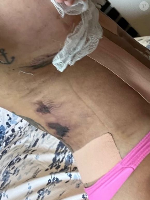 Em nota publicada pelo portal Splash, a JK alegou que ‘intercorrências como necrose são eventos conhecidos na literatura médica e não estão integralmente sob controle do profissional’