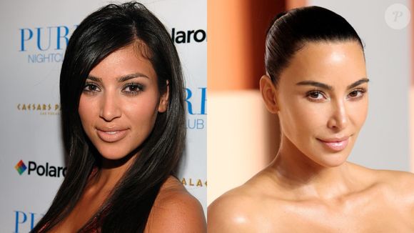 Quando bem feita, a harmonização facial apresenta resultados naturais, como este de Kim Kardashian