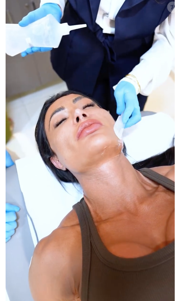 Gracyanne Barbosa passou por um procedimento com o laser XERF, que segundo o dermatologista é o queridinho das Kardashians