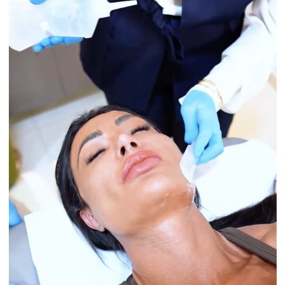 Gracyanne Barbosa passou por um procedimento com o laser XERF, que segundo o dermatologista é o queridinho das Kardashians