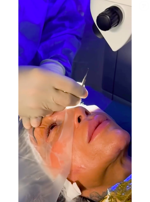 Cirurgia de Maya Massafera é conhecida como 'tatuagem da córnea' e foi realizada em um centro especializado