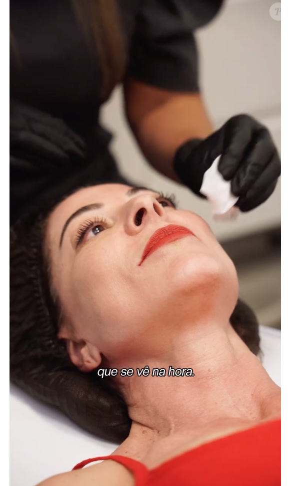 Aos 59 anos, Ana Paula Padrão recorre a procedimentos estéticos para prevenir os efeitos do envelhecimento