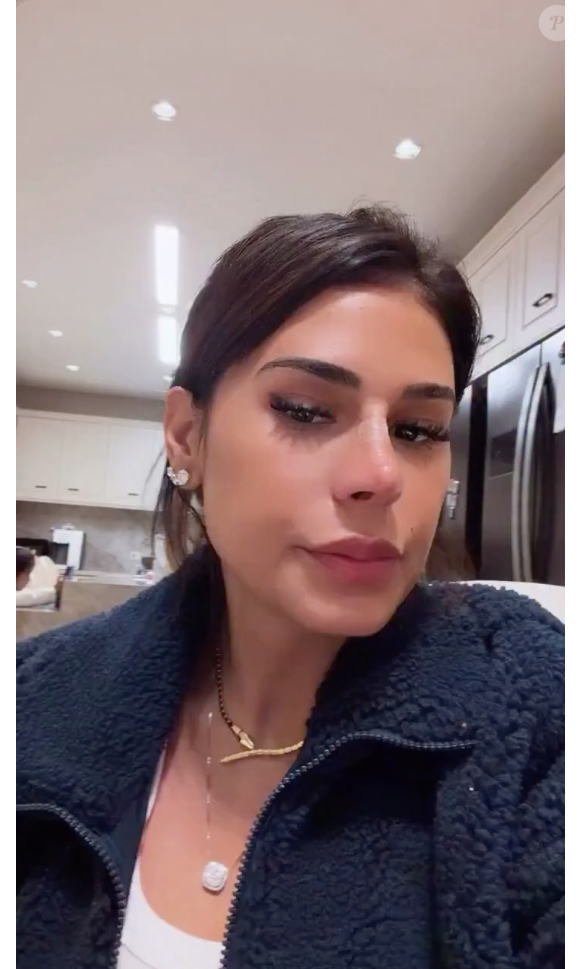 Depois do vídeo viralizar, Simone Mendes veio à público explicar que não fez uma cirurgia plástica no nariz