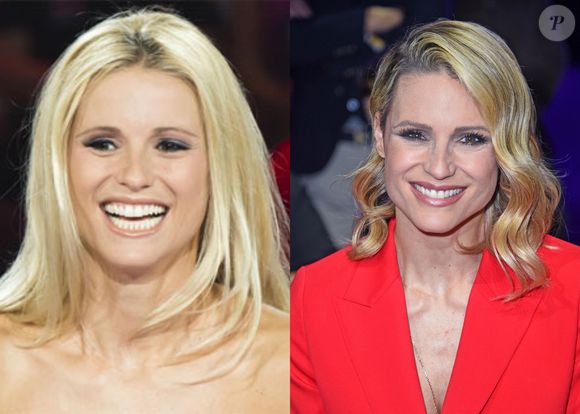 Apresentadora do Eurovision 2025, Michelle revelou que sua idade biológica é de 25 anos, graças a um estilo de vida saudável que inclui exercícios físicos, alimentação equilibrada, práticas holísticas e controle emocional.