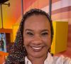 Fora do 'BBB 26', Solange Couto causou ao publicar um ensaio de fotos sensuais em suas redes sociais