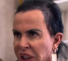 Gretchen voltou a abrir o coração sobre sua vivência com a alopecia androgenética, uma condição que causa afinamento progressivo dos fios e queda de cabelo