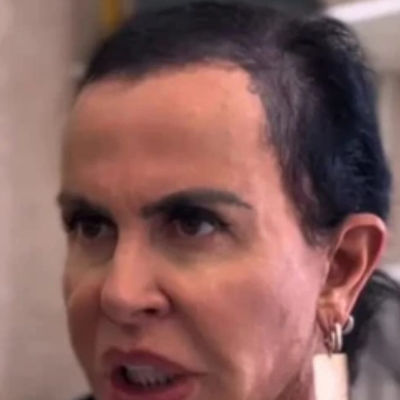 Gretchen voltou a abrir o coração sobre sua vivência com a alopecia androgenética, uma condição que causa afinamento progressivo dos fios e queda de cabelo